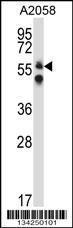 Anti-DPYSL3 Rabbit Polyclonal Antibody