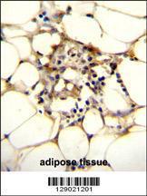 Anti-C9JLR9 Rabbit Polyclonal Antibody (AP (Alkaline Phosphatase))