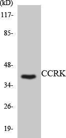 Anti-CCRK antibody