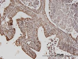 Anti-ERBB3 Mouse Monoclonal Antibody [clone: 4H3]