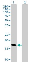 Anti-DUX3 Mouse Polyclonal Antibody