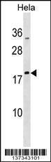 Anti-MRPL48 Rabbit Polyclonal Antibody