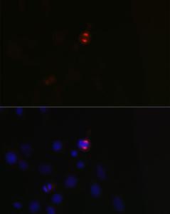 Immunofluorescence analysis of C6 cells using Anti-TPX2 Antibody (A307828) at a dilution of 1:100 (40x lens). DAPI was used to stain the cell nuclei (blue).