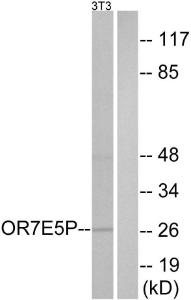 Western blot analysis of lysates from NIH/3T3 cells using Anti-OR7E5P Antibody. The right hand lane represents a negative control, where the antibody is blocked by the immunising peptide