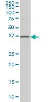 Anti-HSD17B1 Mouse Monoclonal Antibody [clone: 2E5]