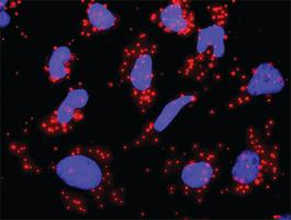 Anti-STAT1 + PIAS1 Antibody Pair