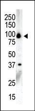 Anti-PRKD3 Rabbit Polyclonal Antibody (AP (Alkaline Phosphatase))