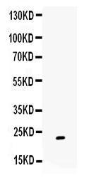 Anti-GREM1 Rabbit Polyclonal Antibody