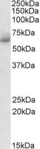 Anti-RHCG Antibody (A84876) (1µg/ml) staining of Human Testis lysate (35µg protein in RIPA buffer). Primary incubation was 1 hour. Detected by chemiluminescence.