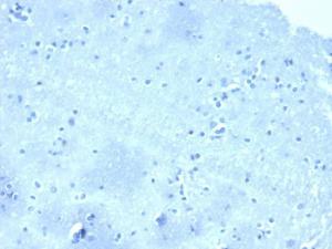 Negative Control: Immunohistochemical analysis of formalin-fixed, paraffin-embedded human brain stained with Anti-delta 1 Catenin Antibody [CTNND1/4501] at 2 µg/ml in PBS for 30 minutes at room temperature