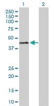 Anti-ERCC1 Rabbit Polyclonal Antibody