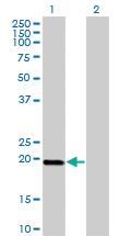 Anti-DUX3 Mouse Monoclonal Antibody [clone: 3D2]