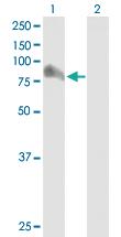 Anti-ARHGAP26 Mouse Polyclonal Antibody