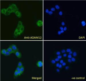 Anti-ADAM12 Antibody (A83260) Immunofluorescence analysis of paraformaldehyde fixed A431 cells, permeabilized with 0.15% Triton