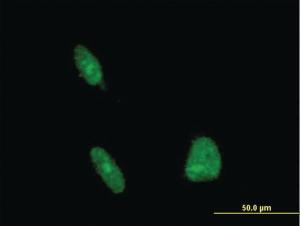 Anti-ERCC1 Mouse Monoclonal Antibody [clone: 3A7]