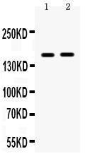 Anti-HDAC6 Rabbit Polyclonal Antibody