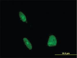 Anti-ERCC1 Mouse Monoclonal Antibody [clone: 3A7]