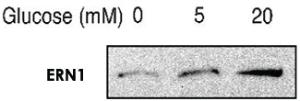 Anti-ERN1 Rabbit Polyclonal Antibody