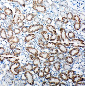 Anti-TRAM1 Rabbit Polyclonal Antibody