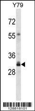 Anti-OR4F16 Rabbit Polyclonal Antibody (HRP (Horseradish Peroxidase))