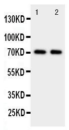 Anti-Prolactin Receptor Rabbit Polyclonal Antibody