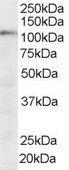 Antibody anti-SART1 100 µg