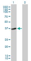 Anti-HSD17B2 Mouse Polyclonal Antibody