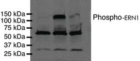 Anti-ERN1 Rabbit Polyclonal Antibody