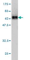 Anti-SERPINI1 Mouse Monoclonal Antibody [clone: 1D10]