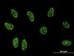 Anti-TSC22D3 Mouse Monoclonal Antibody [clone: 3A5]