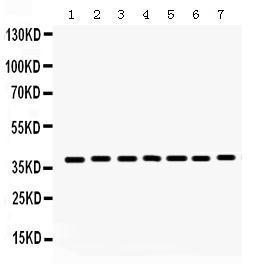 Anti-HDAC11 Rabbit Polyclonal Antibody