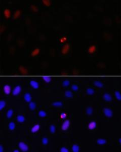 Immunofluorescence analysis of U-2 OS cells using Anti-TPX2 Antibody (A307828) at a dilution of 1:100 (40x lens). DAPI was used to stain the cell nuclei (blue).