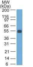 Western blot analysis of rat colon lysate using Anti-EpCAM Antibody [GZ-1]