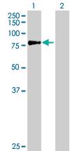 Anti-ERCC2 Mouse Polyclonal Antibody