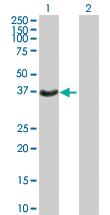 Anti-HSD17B2 Mouse Polyclonal Antibody