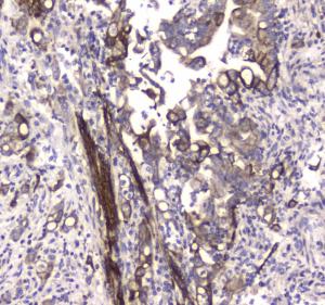 Anti-MAP1LC3A Polyclonal Antibody