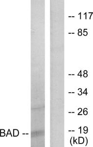 Western blot analysis of lysates from 293 cells, treated with Forskolin using Anti-BAD Antibody. The right hand lane represents a negative control, where the Antibody is blocked by the immunising peptide