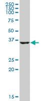 Anti-HSD17B2 Mouse Polyclonal Antibody