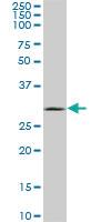 Anti-UCP1 Mouse Monoclonal Antibody [clone: 4B7]