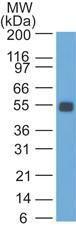 Western blot analysis of rat colon lysate using Anti-EpCAM Antibody [SPM534]