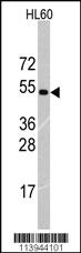 Anti-RNF36 (TRIM69) Rabbit Polyclonal Antibody