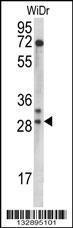 Anti-MRPL9 Rabbit Polyclonal Antibody (AP (Alkaline Phosphatase))