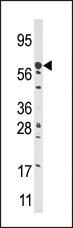 Anti-CPT2 Rabbit Polyclonal Antibody