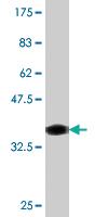 Anti-ATRX Mouse Monoclonal Antibody [clone: 5B3]