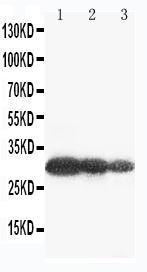 Anti-Aquaporin 6 Rabbit Polyclonal Antibody