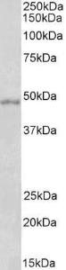 Anti-HCRTR1 Antibody (A83262) (1µg/ml) staining of Mouse Brain lysate (35µg protein in RIPA buffer). Detected by chemiluminescence.