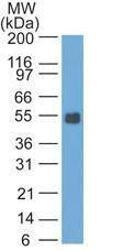 Western blot analysis of rat colon lysate using Anti-EpCAM Antibody [GZ-20]