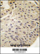 Anti-Connexin 31.1 Rabbit Polyclonal Antibody (HRP (Horseradish Peroxidase))