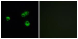 Immunofluorescence analysis of MCF-7 cells using Anti-OR7E5P Antibody. The right hand panel represents a negative control, where the antibody was pre-incubated with the immunising peptide