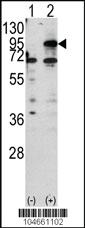 Anti-CPT1B Rabbit Polyclonal Antibody